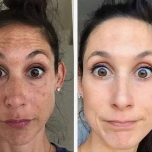 Two 180 Face Wash - Picture 14 of 14